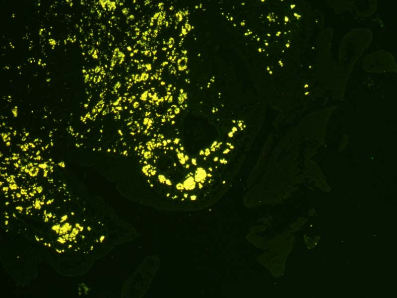 Auramine Rhodamine Fluorescent Staining